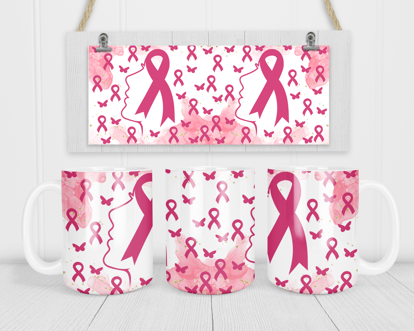 Breast Cancer